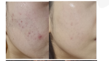 將圖片載入圖庫檢視器 [THE CHEONG AN BIO] Clear Skin Start Bar
